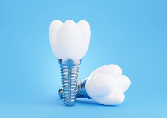 Two dental implants on a blue background