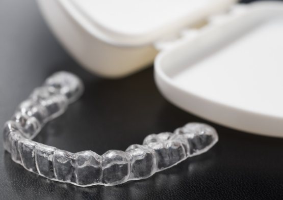 Clear nightguard for bruxism